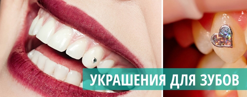 Украшения на зубы Томск Верный